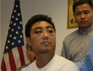 Reynold Liang one of the Asian youths attacked. (Photo by Maurice Pinzon)